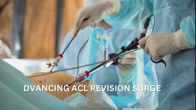 Dallas Surgeon Enhances ACL Revision Success with Quadriceps Tendon Grafts