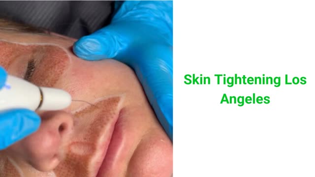 Medical Massage by Samantha - Expert Skin Tightening Treatment in Los Angeles, CA