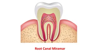 Veneto Dental Care - Trusted Root Canal in Miramar, FL