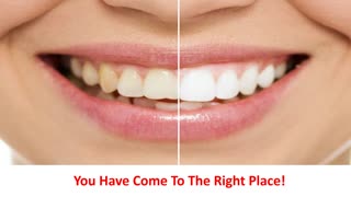 Veneto Dental Care - Professional Invisalign Care in Miramar, FL