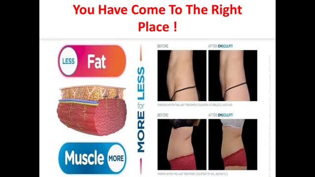 Laser Me: Aesthetics & Wellness | Medical Weight Loss in ST. Louis, MO