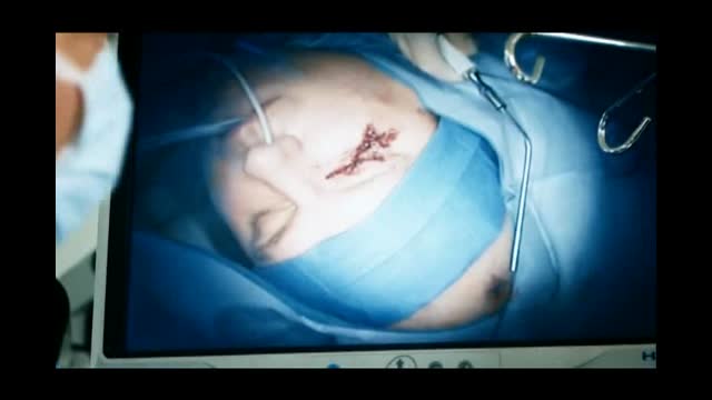 trauma qc saison1 09