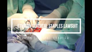 Ethicon Surgical Staples Lawsuit