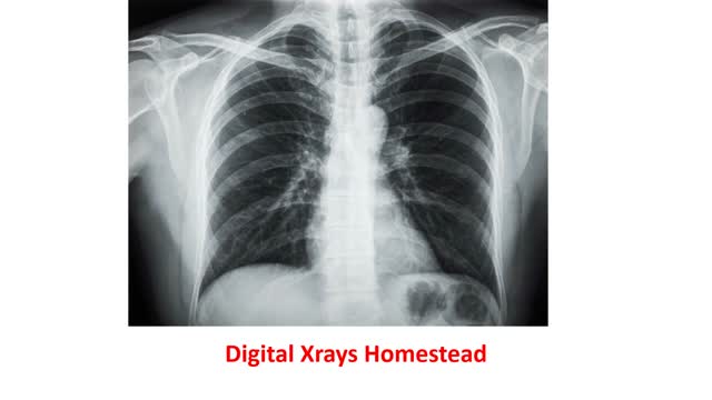 Ultimate Diagnostic Center - Reliable Digital Xrays in Homestead, FL