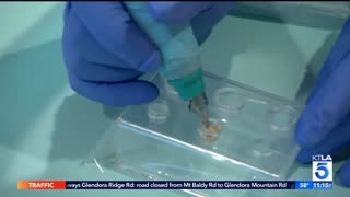 Ruth Swissa Professional Permanent Makeup and Medspa - Scar Camouflage in Calabasas, CA