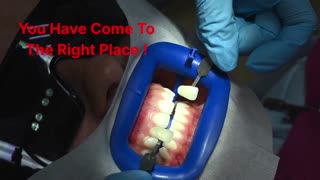 Comfy Smile Dental : Best Veneers in Davie, FL