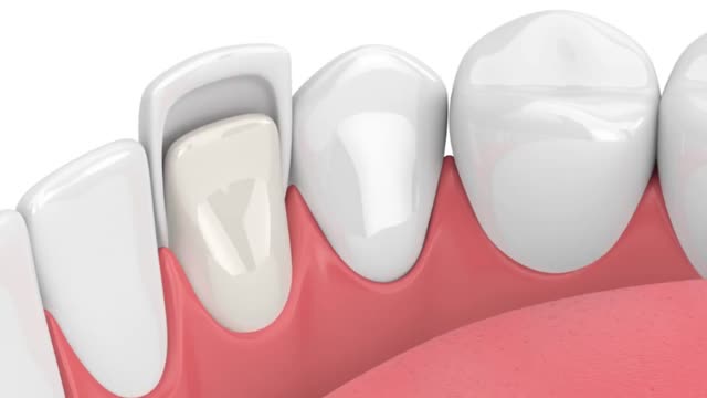 Florida Dental Care of Miller - Leading Dentist in Miami