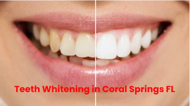 Advanced Dentistry of Coral Springs : #1 Teeth Whitening in Coral Springs, FL