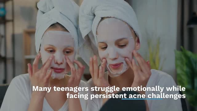 Teen Acne Solutions Singapore