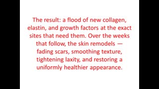 Blu Monarch Skin Studio : Microneedling in San Mateo, CA